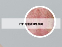 打扫街道清理牛皮癣