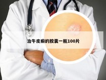 治牛皮癣的胶囊一瓶100片
