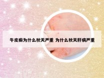 牛皮癣为什么秋天严重 为什么秋天肝病严重