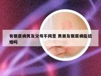 有银屑病男友父母不同意 男朋友银屑病能结婚吗