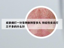 皮肤病打一针生物制剂管多久 特应性皮炎打三千多的什么针