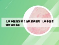 北京中医院治哪个治银屑病最好 北京中医看银屑病哪家好