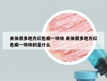 身体很多地方红色癣一块块 身体很多地方红色癣一块块的是什么