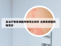 昌治疗银屑病医院哪家比较好 治银屑癣医院哪家好