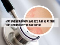红斑狼疮的生物制剂治疗是怎么样的 红斑狼疮的生物制剂治疗是怎么样的呢