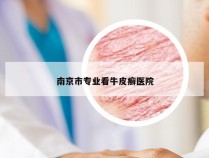 南京市专业看牛皮癣医院