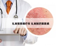 礼来银屑病疗效 礼来制药银屑病