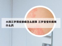 小孩三岁得皮肤癣怎么回事 三岁宝宝长癣用什么药