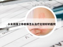 小女孩得了牛皮癣怎么治疗比较好的医院
