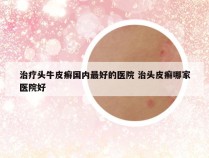 治疗头牛皮癣国内最好的医院 治头皮癣哪家医院好