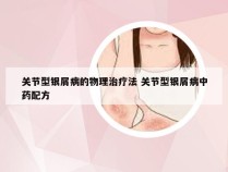 关节型银屑病的物理治疗法 关节型银屑病中药配方