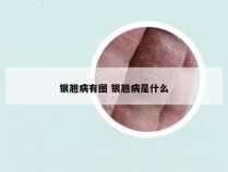 银翘病有图 银翘病是什么