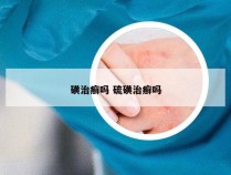 磺治癣吗 硫磺治癣吗