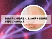 急性点滴状银屑病恶化 急性点滴状银屑病是不是可以终身不复发