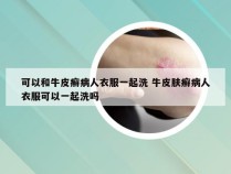 可以和牛皮癣病人衣服一起洗 牛皮肤癣病人衣服可以一起洗吗