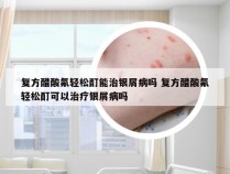 复方醋酸氟轻松酊能治银屑病吗 复方醋酸氟轻松酊可以治疗银屑病吗