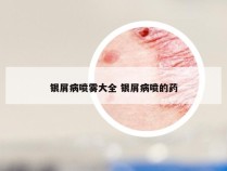 银屑病喷雾大全 银屑病喷的药