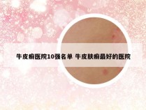 牛皮癣医院10强名单 牛皮肤癣最好的医院