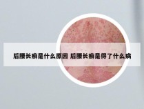 后腰长癣是什么原因 后腰长癣是得了什么病