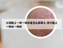 小孩腿上一块一块白是怎么回事儿 孩子腿上一块白一块的