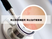 周口银屑病医院 周口治疗银屑病