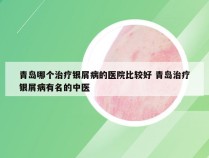青岛哪个治疗银屑病的医院比较好 青岛治疗银屑病有名的中医