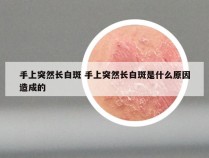 手上突然长白斑 手上突然长白斑是什么原因造成的