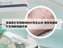荨麻疹打生物制剂的针剂怎么样 慢性荨麻疹打生物制剂副作用