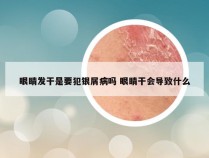眼睛发干是要犯银屑病吗 眼睛干会导致什么