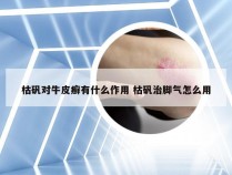 枯矾对牛皮癣有什么作用 枯矾治脚气怎么用