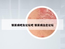 银屑病吧友论坛吧 银屑病治愈论坛