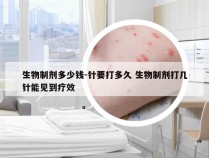 生物制剂多少钱-针要打多久 生物制剂打几针能见到疗效