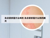 白点症状是什么样的 白点症状是什么样的图片