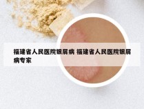 福建省人民医院银屑病 福建省人民医院银屑病专家