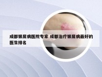 成都银屑病医院专家 成都治疗银屑病最好的医生排名