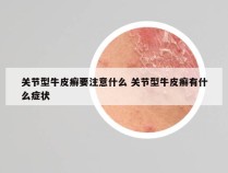 关节型牛皮癣要注意什么 关节型牛皮癣有什么症状