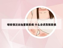 哪些情况会加重银屑病 什么会诱发银屑病