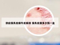供应保良皮癣牛皮癣液 保良皮康多少钱一盒