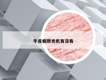 牛皮癣照光机有没有