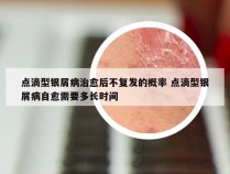 点滴型银屑病治愈后不复发的概率 点滴型银屑病自愈需要多长时间