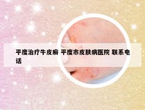 平度治疗牛皮癣 平度市皮肤病医院 联系电话