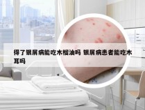 得了银屑病能吃木榴油吗 银屑病患者能吃木耳吗