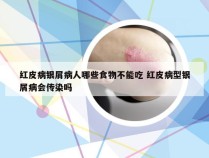 红皮病银屑病人哪些食物不能吃 红皮病型银屑病会传染吗