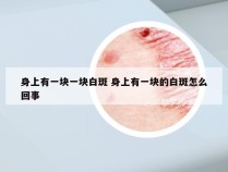 身上有一块一块白斑 身上有一块的白斑怎么回事