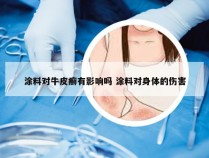 涂料对牛皮癣有影响吗 涂料对身体的伤害