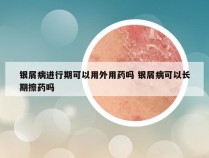 银屑病进行期可以用外用药吗 银屑病可以长期擦药吗