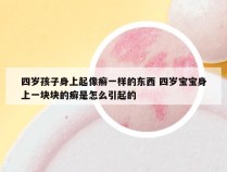 四岁孩子身上起像癣一样的东西 四岁宝宝身上一块块的癣是怎么引起的