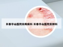 长春华山医院白殿疯科 长春华山医院皮肤科