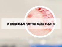 银屑病初期小红疙瘩 银屑病起初的小红点