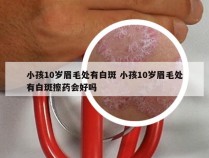 小孩10岁眉毛处有白斑 小孩10岁眉毛处有白斑擦药会好吗